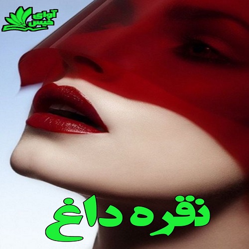 نقره داغ